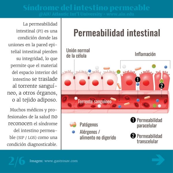 67MyAIUSlidesSpanish02