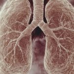 Inhalable Sensors: A Game-Changer for Early Lung Cancer Detection